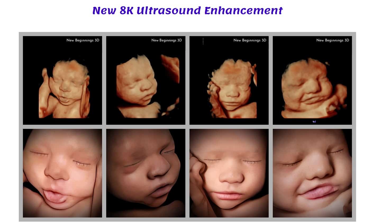 modern ultrasounds prove unborn children 01