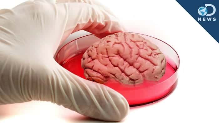 scientists are growing human brains in labs one brain spontaneously grew eyes 01