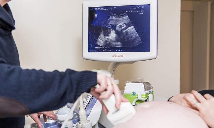 ultrasound pregnancy 01