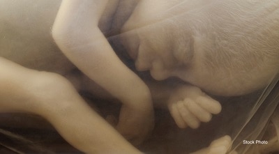 20 week old baby in utero preborn 01