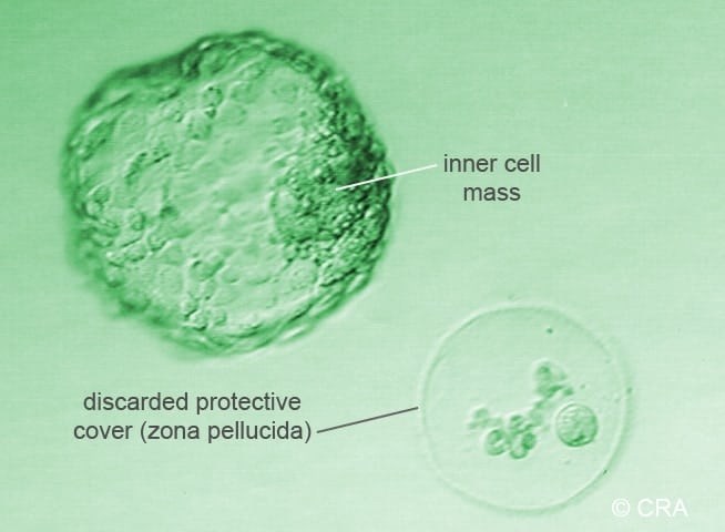 10 cells