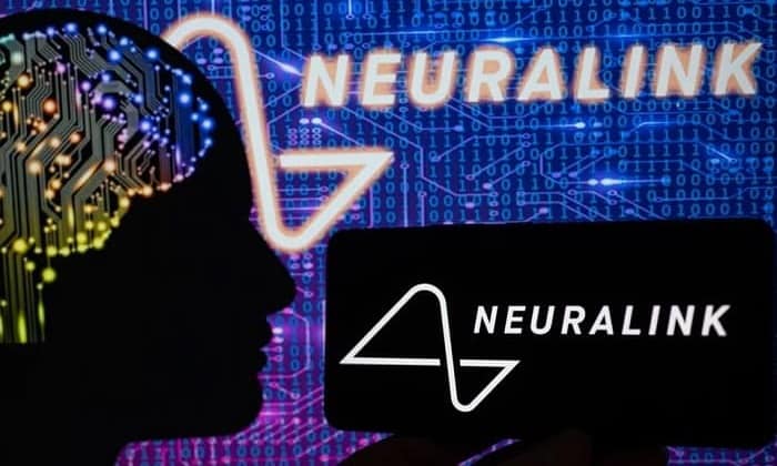 neuralink 01